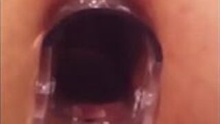 Speculum and fuck - porn video