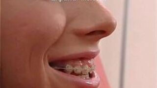 Sandra Skinny Teen Braces Anal Facial - porn video